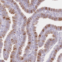 WDR54 Antibody, Novus Biologicals 0.1mL; Unlabeled:Antibodies, Polyclonal