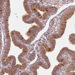 WDR54 Antibody, Novus Biologicals 25 &mu;L; Unlabeled:Antibodies, Polyclonal