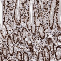 WDR57 Antibody, Novus Biologicals 0.1mL; Unlabeled:Antibodies, Polyclonal