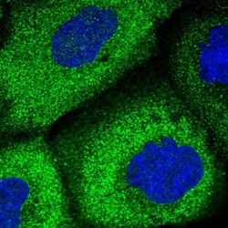 WDR6 Antibody, Novus Biologicals 0.1mL; Unlabeled:Antibodies, Polyclonal