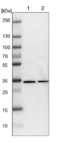WDR61 Antibody, Novus Biologicals 25 &mu;L; Unlabeled:Antibodies, Polyclonal