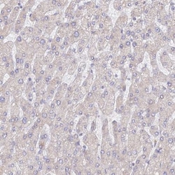 WDR62 Antibody, Novus Biologicals 25 &mu;L; Unlabeled:Antibodies, Polyclonal