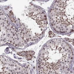 WDR63 Antibody, Novus Biologicals 25 &mu;L, Unlabeled:Antibodies, Polyclonal