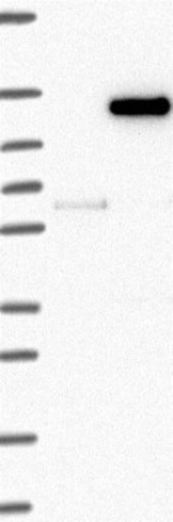 WDR63 Antibody, Novus Biologicals 25 &mu;L, Unlabeled:Antibodies, Polyclonal