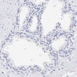 WDR65 Antibody, Novus Biologicals 25 &mu;L; Unlabeled:Antibodies, Polyclonal