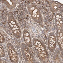 WDR85 Antibody, Novus Biologicals 0.1mL; Unlabeled:Antibodies, Polyclonal