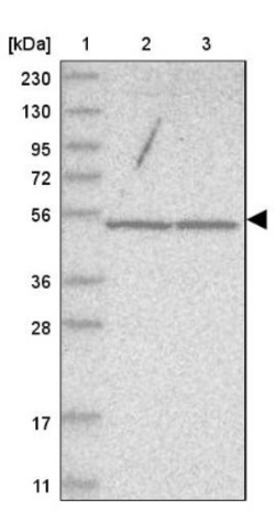 WDR85 Antibody, Novus Biologicals 0.1mL; Unlabeled:Antibodies, Polyclonal