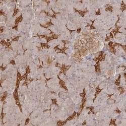WDR9 Antibody, Novus Biologicals:Antibodies:Primary Antibodies