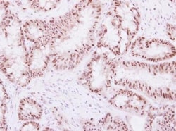 WDR91 Antibody, Novus Biologicals 0.1mL; Unlabeled:Antibodies, Polyclonal