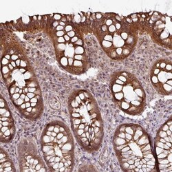 WDSOF1 Antibody, Novus Biologicals 0.1mL; Unlabeled:Anticorps, Polyclonal