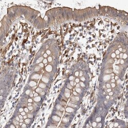 WDTC1 Antibody, Novus Biologicals 0.1mL; Unlabeled:Antibodies, Polyclonal