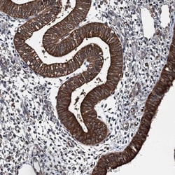 WHAMM Antibody, Novus Biologicals 25 &mu;L; Unlabeled:Antibodies, Polyclonal