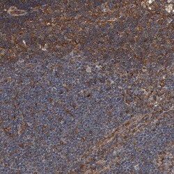 WHAMM Antibody, Novus Biologicals 25 &mu;L; Unlabeled:Antibodies, Polyclonal
