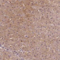 WHSC1 Antibody, Novus Biologicals:Antibodies:Primary Antibodies