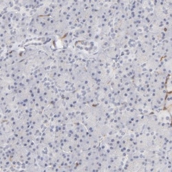 WIPF1/WIP Antibody, Novus Biologicals 25 &mu;L; Unlabeled:Antibodies, Polyclonal