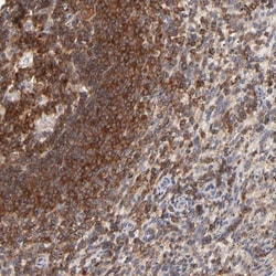 WIPF1/WIP Antibody, Novus Biologicals 25 &mu;L; Unlabeled:Antibodies, Polyclonal