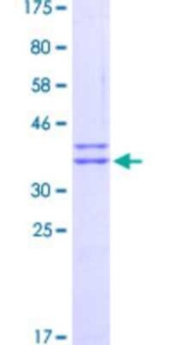 Novus Biologicals Recombinant Human WIPI1 GST (N-Term) Protein 25 &mu;g | Buy Online | Novus Biologicals&trade; | Fisher Scientific