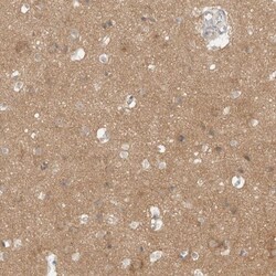 WIRE Antibody, Novus Biologicals 25 &mu;L; Unlabeled:Antibodies, Polyclonal