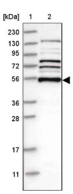 SNX16 Antibody, Novus Biologicals:Antibodies:Primary Antibodies