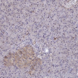 WNK1 Antibody, Novus Biologicals:Antibodies:Primary Antibodies