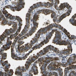 WNK2 Antibody, Novus Biologicals:Antibodies:Primary Antibodies