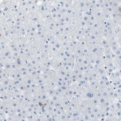 WNK2 Antibody, Novus Biologicals:Antibodies:Primary Antibodies