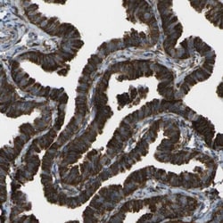 WNK2 Antibody, Novus Biologicals 0.1mL; Unlabeled:Antibodies, Polyclonal