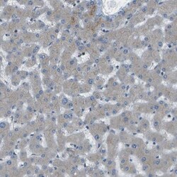 WNK2 Antibody, Novus Biologicals 0.1mL; Unlabeled:Antibodies, Polyclonal