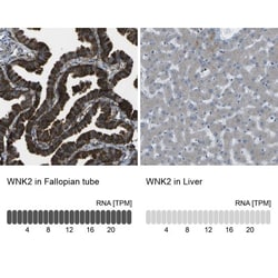 WNK2 Antibody, Novus Biologicals 0.1mL; Unlabeled:Antibodies, Polyclonal