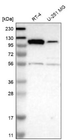 WNK2 Antibody, Novus Biologicals 0.1mL; Unlabeled:Antibodies, Polyclonal