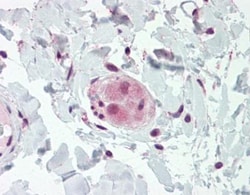 WRCH1 Antibody, Novus Biologicals 0.1mg; Unlabeled:Antibodies, Polyclonal