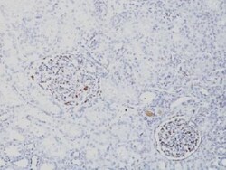 WT1 Antibody (SPM361), Novus Biologicals 0.2mg; Unlabeled:Antibodies, Monoclonal