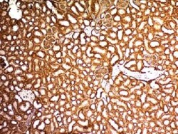 WT1 Antibody (WT1/857), Novus Biologicals 0.2mg; Unlabeled:Antibodies,
