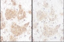 WWOX Antibody, Novus Biologicals 0.1mg; Unlabeled:Antibodies, Polyclonal