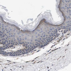 Wnt-10a Antibody, Novus Biologicals 0.1mL; Unlabeled:Antibodies, Polyclonal