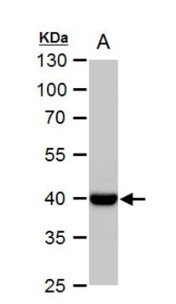 Wnt-11 Antibody, Novus Biologicals 0.1mg; Unlabeled:Antibodies, Polyclonal