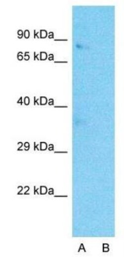 Wnt-3a Antibody, Novus Biologicals 0.05mg; Unlabeled:Antibodies, Polyclonal