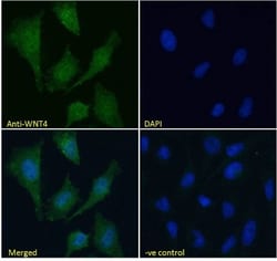 Wnt-4 Antibody, Novus Biologicals 0.1mg; Unlabeled:Antibodies, Polyclonal