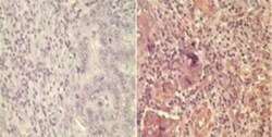 Wnt-5a Antibody - BSA Free, Novus Biologicals:Antibodies:Primary Antibodies