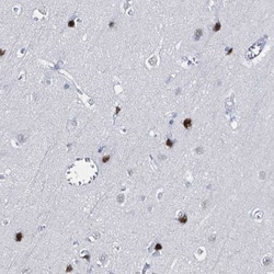 XAGE3 Antibody, Novus Biologicals 25 &mu;L, Unlabeled:Antibodies, Polyclonal
