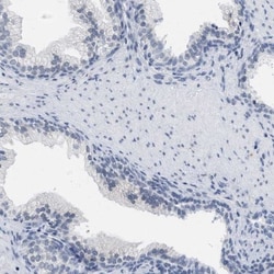 XIRP1 Antibody, Novus Biologicals:Antibodies:Primary Antibodies