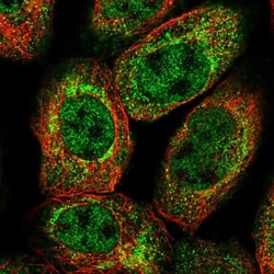 XK X-linked Kx blood group Antibody, Novus Biologicals:Antibodies:Primary