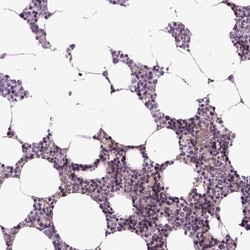 XK X-linked Kx blood group Antibody, Novus Biologicals:Antibodies:Primary