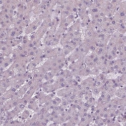 XK X-linked Kx blood group Antibody, Novus Biologicals:Antibodies:Primary