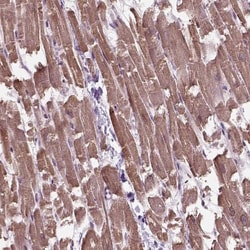 XK X-linked Kx blood group Antibody, Novus Biologicals:Antibodies:Primary