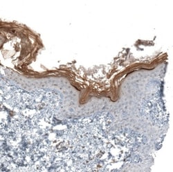 XP32 Antibody, Novus Biologicals:Antibodies:Primary Antibodies