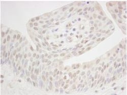 XPB Antibody, Novus Biologicals 0.1mg; Unlabeled:Antibodies, Polyclonal