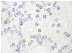 XPB Antibody, Novus Biologicals 0.1mg; Unlabeled:Antibodies, Polyclonal