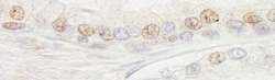 XPB Antibody, Novus Biologicals 0.1mg; Unlabeled:Antibodies, Polyclonal