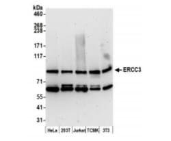 XPB Antibody, Novus Biologicals 0.1mg; Unlabeled:Antibodies, Polyclonal